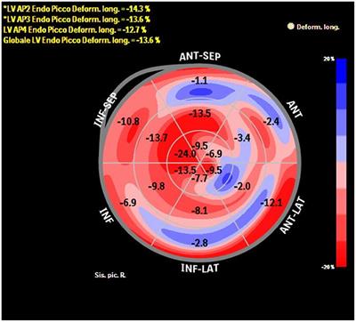 Novel Imaging and Genetic Risk Markers in Takotsubo Syndrome